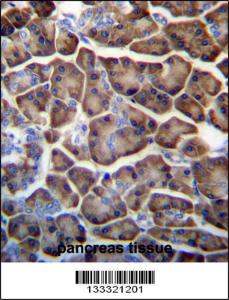 Anti-KCTD3 Rabbit Polyclonal Antibody (HRP (Horseradish Peroxidase))