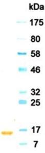 Western blotting result