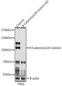 Anti-delta 1 Catenin/CAS antibody