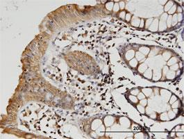 Anti-TUBB2A Mouse Monoclonal Antibody [clone: 4B12]