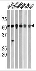 Anti-CHEK1 Rabbit Polyclonal Antibody (HRP (Horseradish Peroxidase))