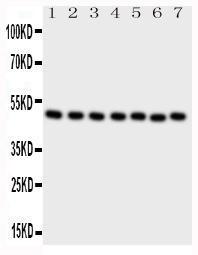 Anti-CTBP2 Rabbit Polyclonal Antibody