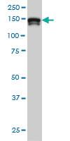 Anti-STAG2 Mouse Monoclonal Antibody [clone: 3C6]