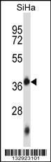 Anti-DNTTIP1 Rabbit Polyclonal Antibody (AP (Alkaline Phosphatase))