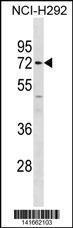 Anti-MMP14 Rabbit Polyclonal Antibody (APC (Allophycocyanin))