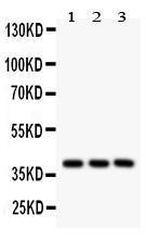 Anti-PTGER2 Rabbit Polyclonal Antibody