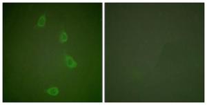 Immunofluorescence analysis of NIH/3T3 cells using Anti-HSP40 Antibody. The right hand panel represents a negative control, where the antibody was pre-incubated with the immunising peptide