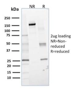 SDS-PAGE analysis of Anti-Glyoxalase 1 Antibody [CPTC-GLO1-1] under non-reduced and reduced conditions; showing intact IgG and intact heavy and light chains, respectively. SDS-PAGE analysis confirms the integrity and purity of the antibody.