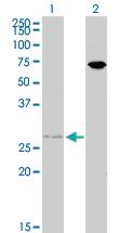 Anti-HOXB7 Mouse Monoclonal Antibody [clone: 4A3]