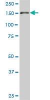 Anti-STAG2 Mouse Monoclonal Antibody [clone: 3C6]