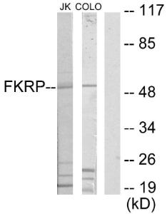 Western blot analysis of lysates from Jurkat and COLO205 cells using Anti-FKRP Antibody The right hand lane represents a negative control, where the antibody is blocked by the immunising peptide