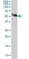 Anti-AKT3 Mouse Monoclonal Antibody [clone: 6F12]