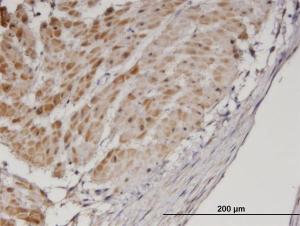 Anti-TPM3 Mouse Monoclonal Antibody [clone: 2E4]