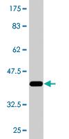 Anti-AGER Mouse Monoclonal Antibody [clone: 1D1]