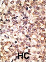 Anti-TLR2 Rabbit Polyclonal Antibody (FITC (Fluorescein))