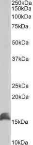 Anti-CUTA antibody