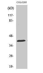 Western blot analysis of various cells using Anti-HSP40 Antibody