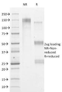 SDS-PAGE analysis of Anti-HSV1 Antibody [HSVI/2095] under non-reduced and reduced conditions; showing intact IgG and intact heavy and light chains, respectively. SDS-PAGE analysis confirms the integrity and purity of the antibody