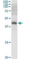 Anti-PBK Polyclonal Antibody Pair