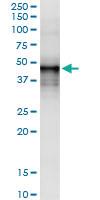 Anti-DNASE2 Polyclonal Antibody Pair