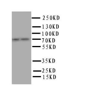 Anti-PPP1R15B Rabbit Polyclonal Antibody