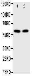 Anti-E2F1 Rabbit Polyclonal Antibody