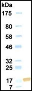 Western blotting res µlt