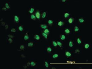 Anti-STAG2 Mouse Monoclonal Antibody [clone: 3C6]