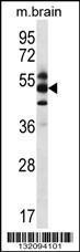 Anti-GPS1 Rabbit Polyclonal Antibody (FITC (Fluorescein Isothiocyanate))