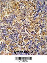 Anti-IBTK Rabbit Polyclonal Antibody (APC (Allophycocyanin))