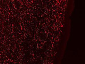 Anti-GAL Antibody (A84722) (0.3 µg/ml) staining of PFA-perfused cryosection of Human Hypothalamus. Antigen retrieval with citrate buffer pH 6 at 80C for 30min, Cy3-staining