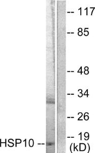 Western blot analysis of lysates from NIH/3T3 cells using Anti-HSP10 Antibody. The right hand lane represents a negative control, where the antibody is blocked by the immunising peptide.