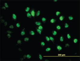 Anti-STAG2 Mouse Monoclonal Antibody [clone: 3C6]