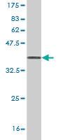 Anti-UMPS Mouse Monoclonal Antibody [clone: 2F5]