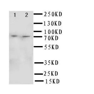 Anti-SDHA Rabbit Polyclonal Antibody