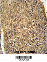 Anti-ATG13 Rabbit Polyclonal Antibody (FITC (Fluorescein Isothiocyanate))