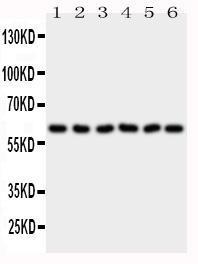 Anti-PAK1 Rabbit Polyclonal Antibody