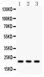 Anti-SDC4 Rabbit Polyclonal Antibody