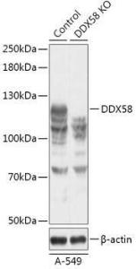 Anti-RIG-I/DDX58 Rabbit Polyclonal Antibody