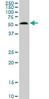 Anti-AKT3 Mouse Monoclonal Antibody [clone: 6F12]