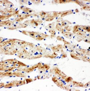 Anti-SDHB Rabbit Polyclonal Antibody