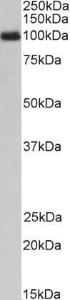 Anti-CSF3R Antibody (A83128) (1 µg/ml) staining of Peripheral Blood Lymphocytes lysate (35 µg protein in RIPA buffer) Primary incubation was 1 hour Detected by chemiluminescence