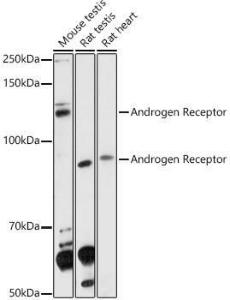 Western blot analysis of extracts of various cell lines, using Anti-Androgen Receptor Antibody (A92793) at 1:1000 dilution