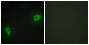 Antibody anti-DOK7 100 µg