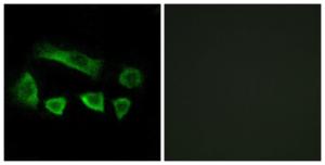 Anti-NT5C1B antibody