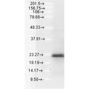 Western blot analysis of human lung carcinoma epithelial cell line (A549) lysate showing detection of BIM protein using Anti-Bim Antibody (A304982) at 1:1,000 for 2 hours at room temperatur