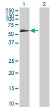 Anti-BMPR1B Mouse Polyclonal Antibody