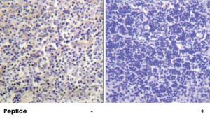 Anti-HBP1 Rabbit Polyclonal Antibody