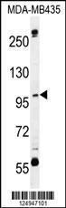 Anti-CA026 Rabbit Polyclonal Antibody (Biotin)