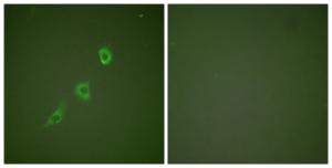 Immunofluorescence analysis of NIH/3T3 cells using Anti-HSP10 Antibody. The right hand panel represents a negative control, where the antibody was pre-incubated with the immunising peptide.